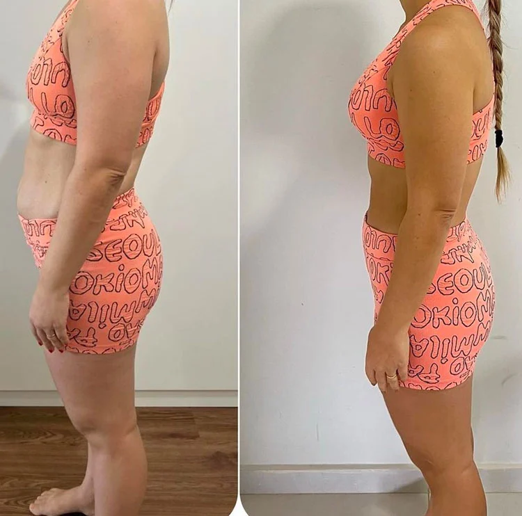 Antes e Depois