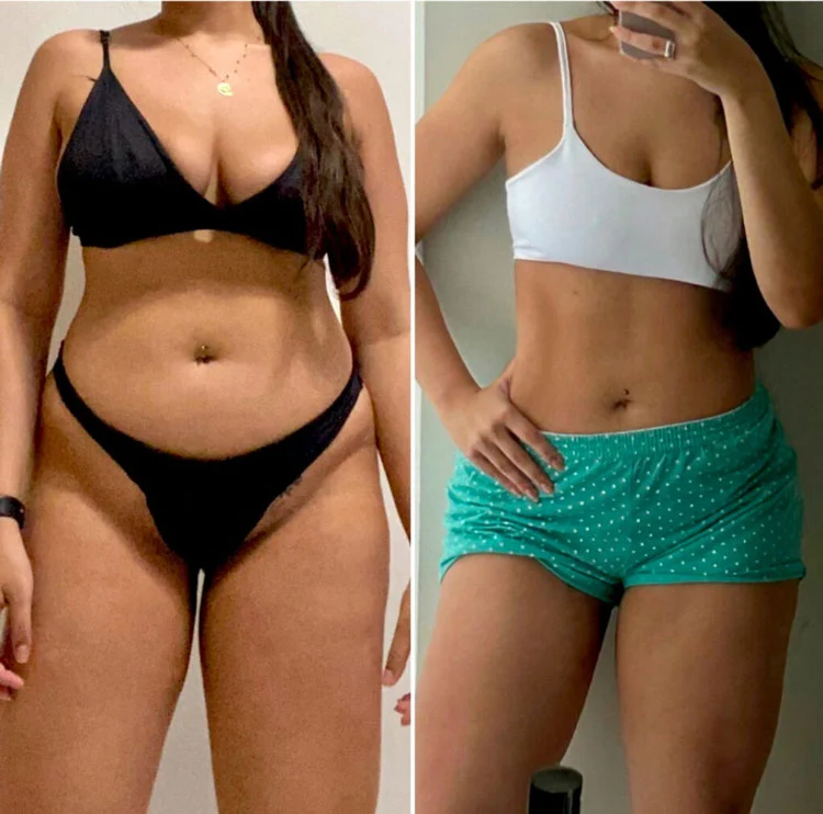 Antes e Depois
