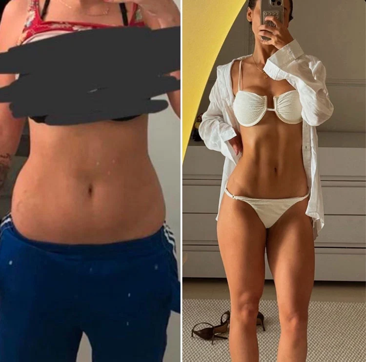 Antes e Depois